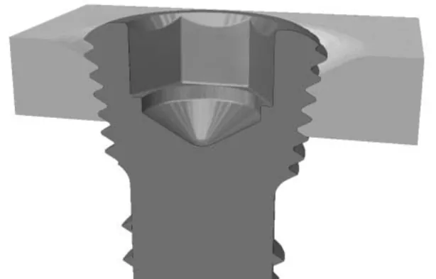 Magnetoterapia tras osteosíntesis (placas y tornillos)